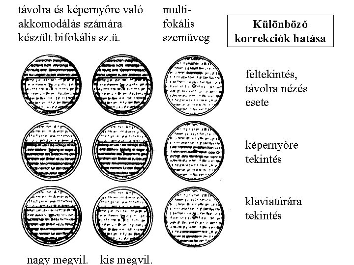 távolra és képernyőre való akkomodálás számára készült bifokális sz. ü. multifokális szemüveg Különböző korrekciók