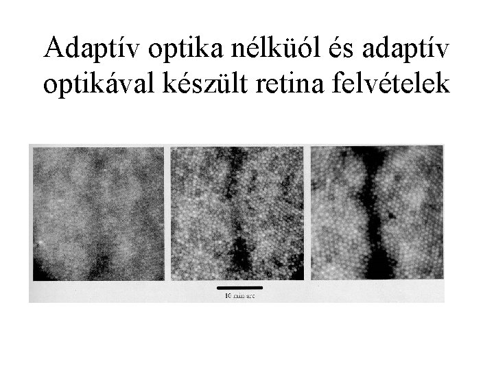 Adaptív optika nélküól és adaptív optikával készült retina felvételek 