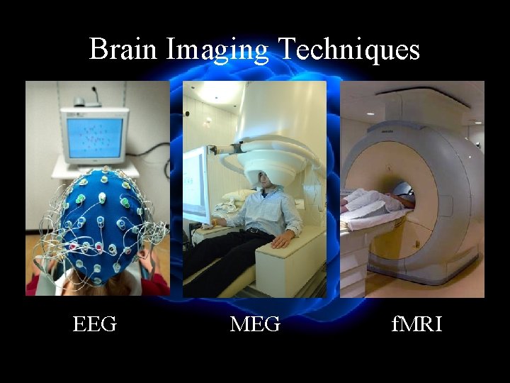 Brain Imaging Techniques EEG MEG f. MRI 