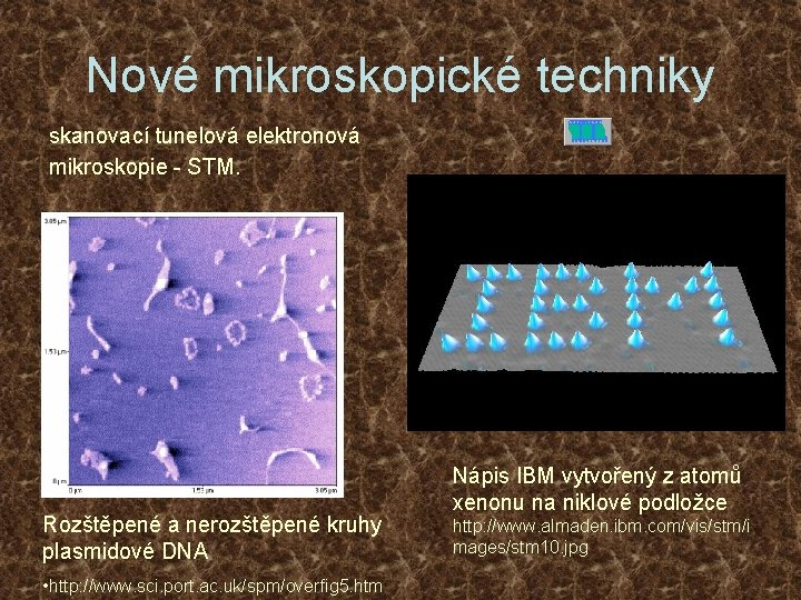 Nové mikroskopické techniky skanovací tunelová elektronová mikroskopie - STM. Rozštěpené a nerozštěpené kruhy plasmidové