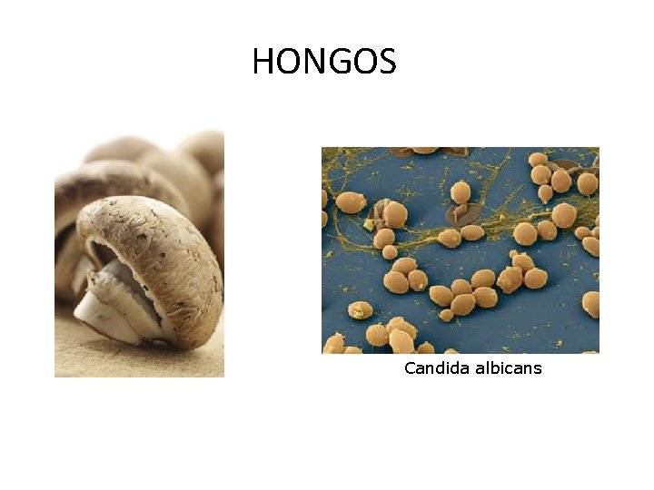 HONGOS Candida albicans 