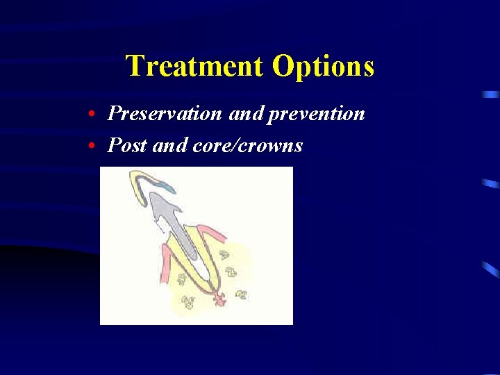 Treatment Options • Preservation and prevention • Post and core/crowns 