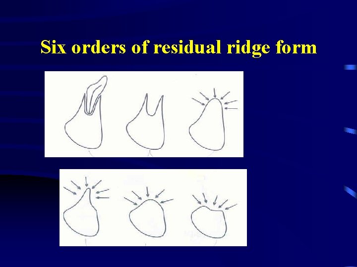 Six orders of residual ridge form 