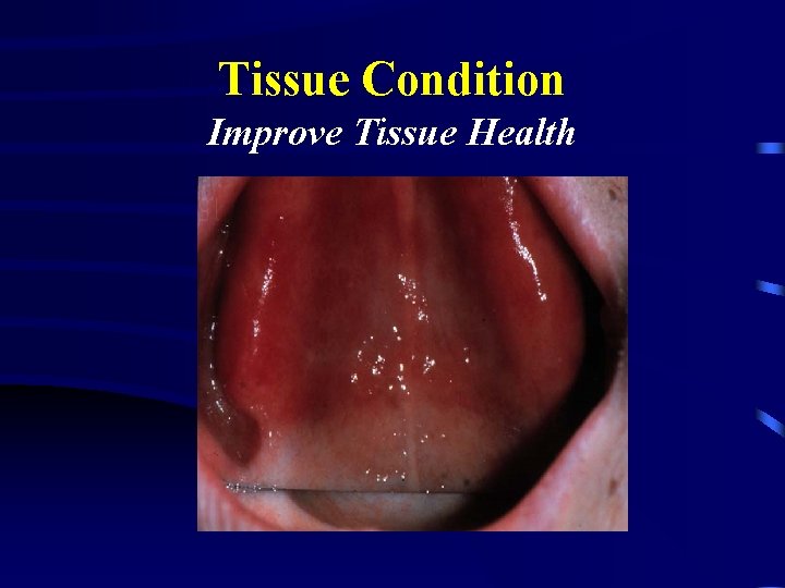 Tissue Condition Improve Tissue Health 