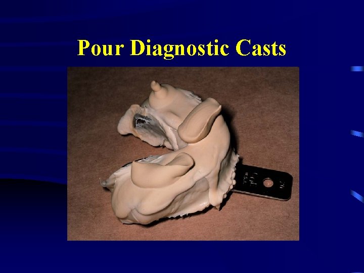 Pour Diagnostic Casts 