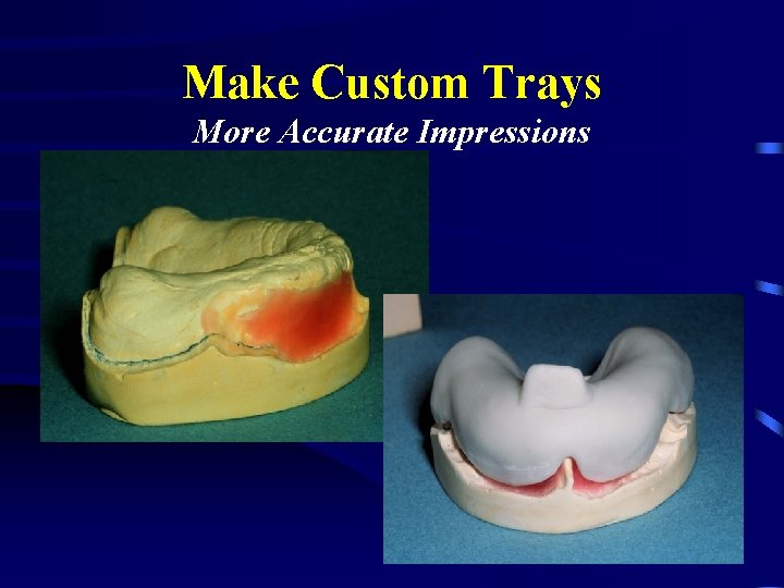 Make Custom Trays More Accurate Impressions 