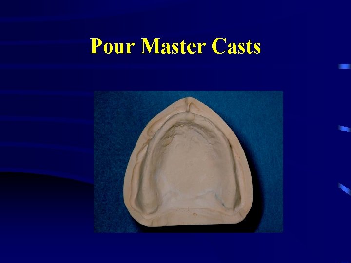 Pour Master Casts 