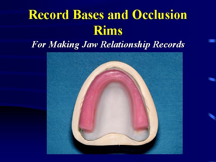 Record Bases and Occlusion Rims For Making Jaw Relationship Records 