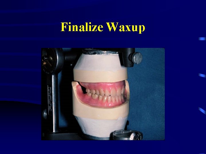 Finalize Waxup 