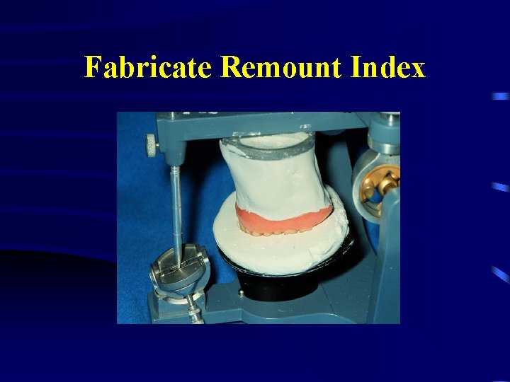 Fabricate Remount Index 