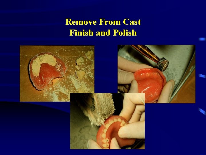 Remove From Cast Finish and Polish 