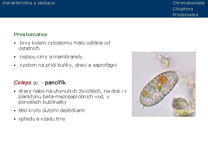 charakteristika a zástupce Prostomatea § brvy kolem cytostomu málo odlišné od ostatních § nejsou