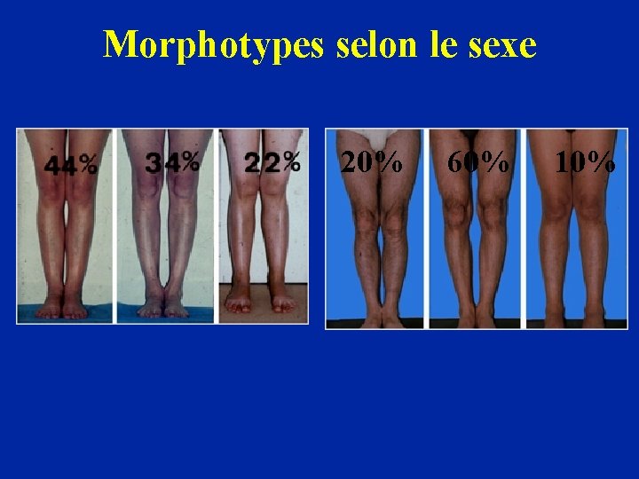 Morphotypes selon le sexe 20% 60% 10% 