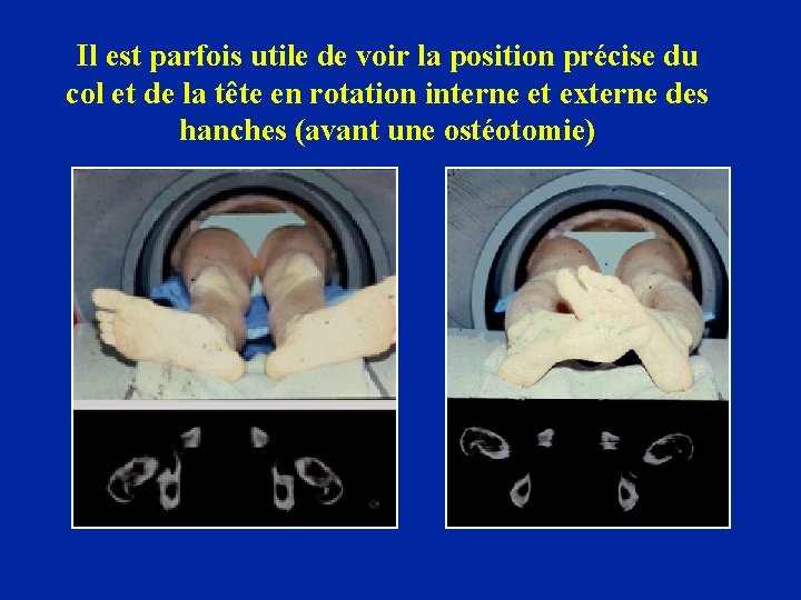 Il est parfois utile de voir la position précise du col et de la