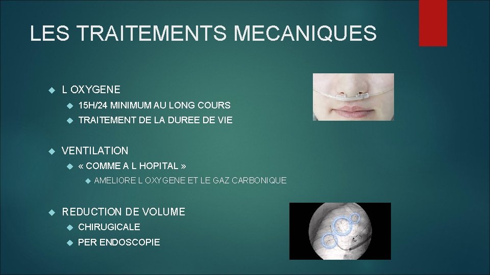 LES TRAITEMENTS MECANIQUES L OXYGENE 15 H/24 MINIMUM AU LONG COURS TRAITEMENT DE LA