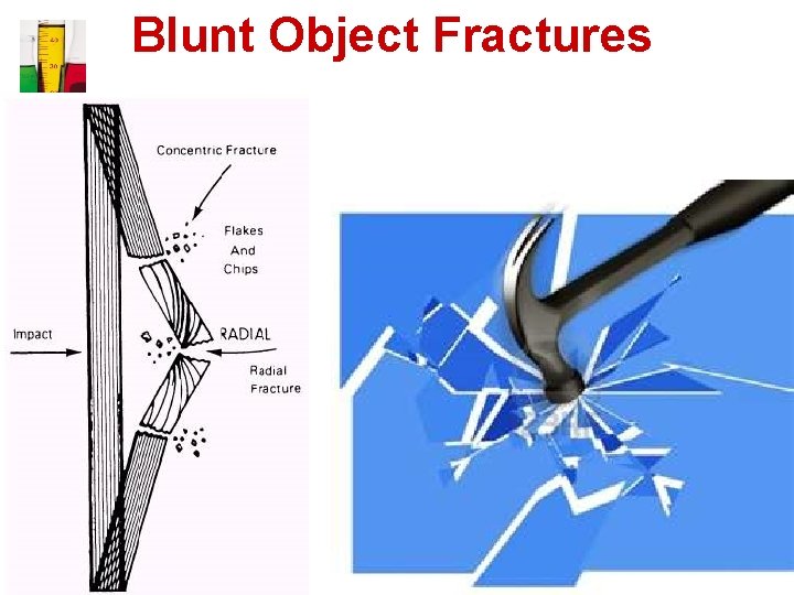 Blunt Object Fractures 