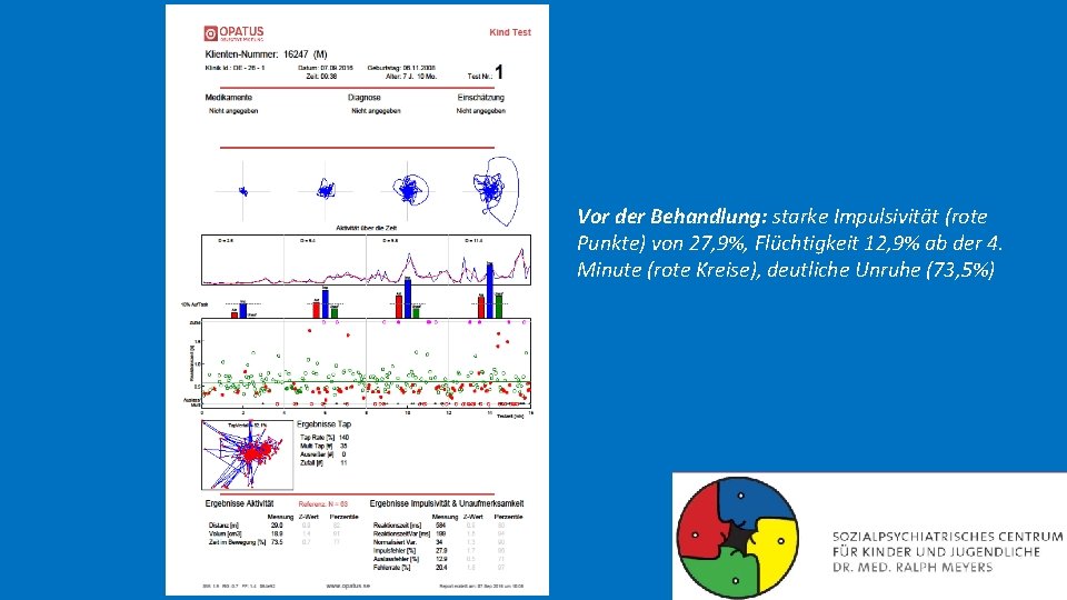 Vor der Behandlung: starke Impulsivität (rote Punkte) von 27, 9%, Flüchtigkeit 12, 9% ab