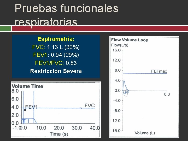 Pruebas funcionales respiratorias Espirometría: FVC: 1. 13 L (30%) FEV 1: 0. 94 (29%)