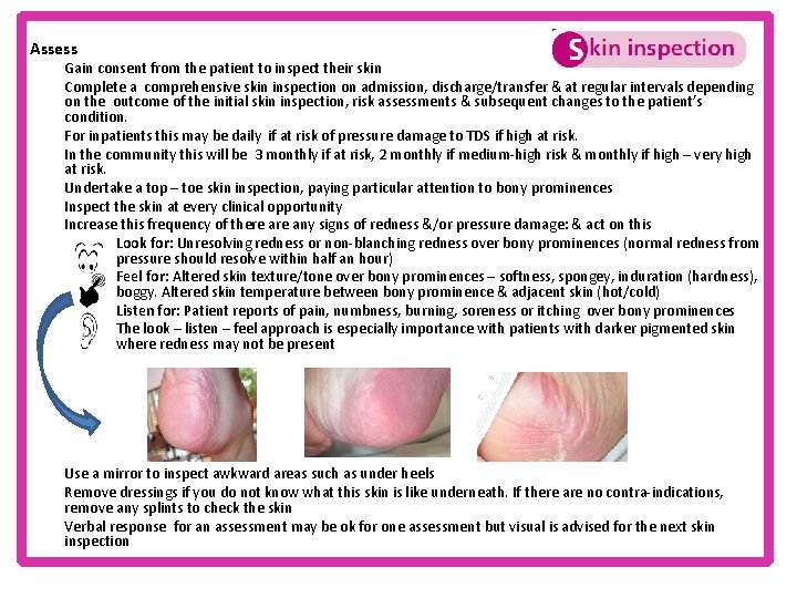 Assess Gain consent from the patient to inspect their skin Complete a comprehensive skin