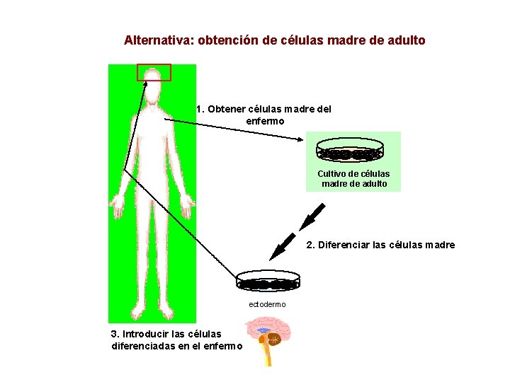 Alternativa: obtención de células madre de adulto 1. Obtener células madre del enfermo Cultivo