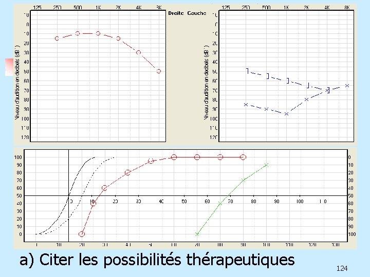  a) Citer les possibilités thérapeutiques 124 