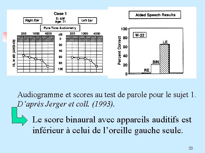 Audiogramme et scores au test de parole pour le sujet 1. D’après Jerger et