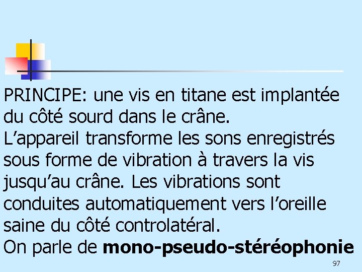 PRINCIPE: une vis en titane est implantée du côté sourd dans le crâne. L’appareil