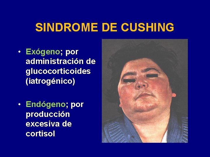 SINDROME DE CUSHING • Exógeno; por administración de glucocorticoides (iatrogénico) • Endógeno; por producción