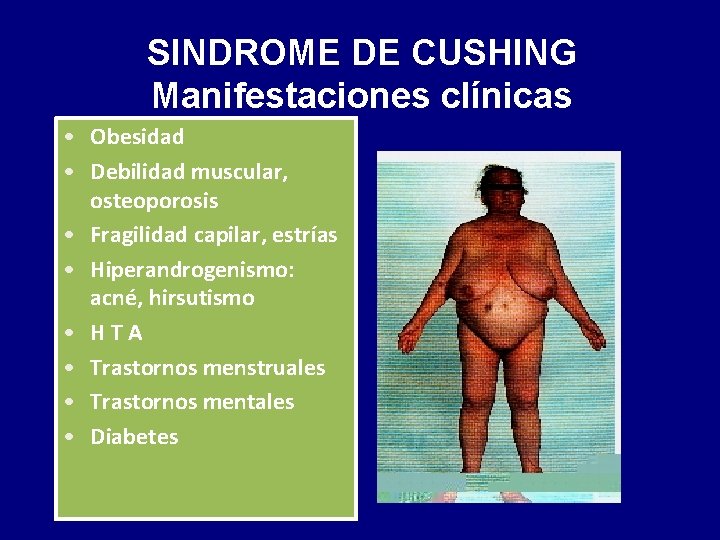 SINDROME DE CUSHING Manifestaciones clínicas • Obesidad • Debilidad muscular, osteoporosis • Fragilidad capilar,