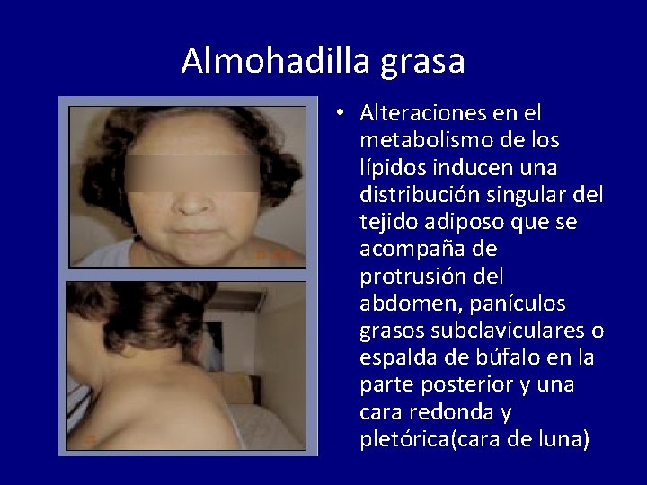 Almohadilla grasa • Alteraciones en el metabolismo de los lípidos inducen una distribución singular