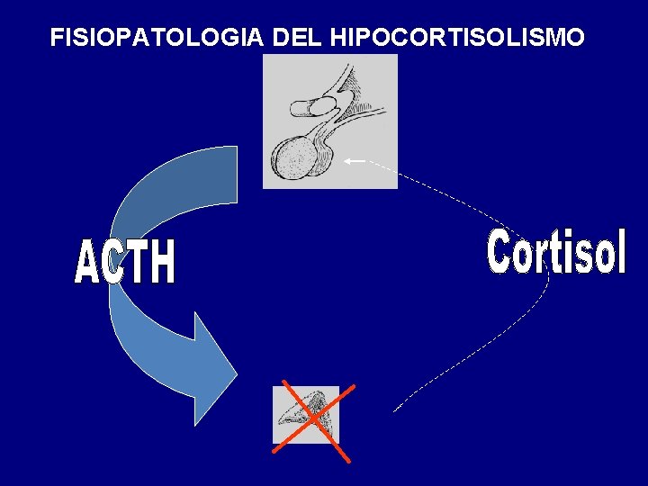 FISIOPATOLOGIA DEL HIPOCORTISOLISMO 