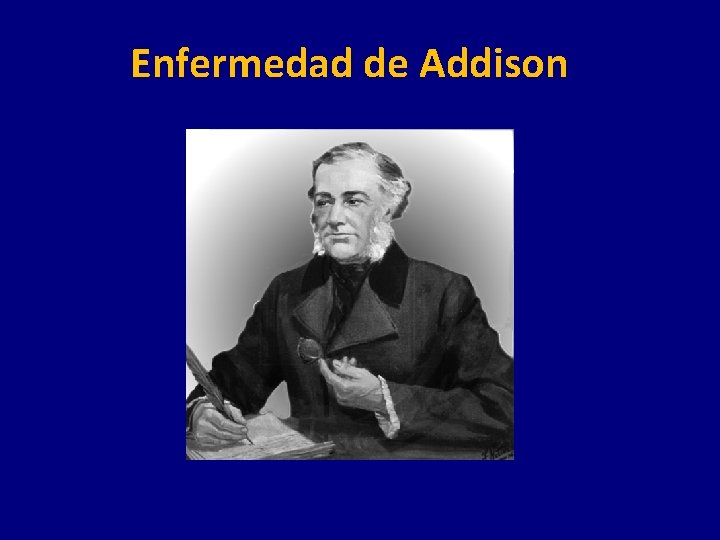 Enfermedad de Addison 
