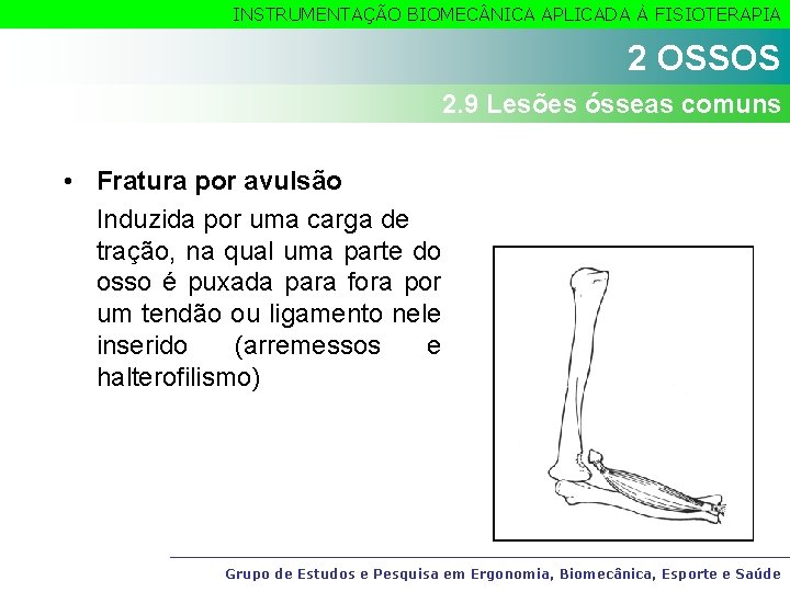 INSTRUMENTAÇÃO BIOMEC NICA APLICADA À FISIOTERAPIA 2 OSSOS 2. 9 Lesões ósseas comuns •