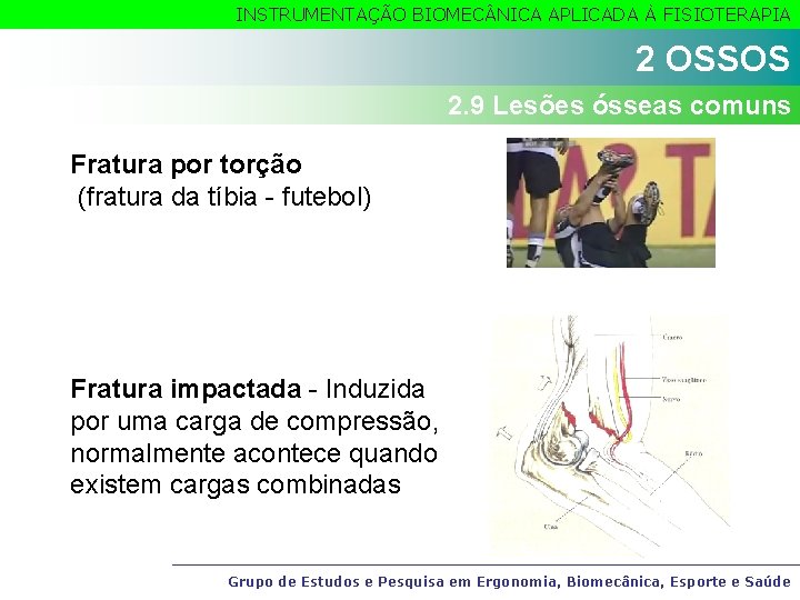 INSTRUMENTAÇÃO BIOMEC NICA APLICADA À FISIOTERAPIA 2 OSSOS 2. 9 Lesões ósseas comuns Fratura