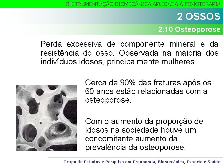 INSTRUMENTAÇÃO BIOMEC NICA APLICADA À FISIOTERAPIA 2 OSSOS 2. 10 Osteoporose Perda excessiva de