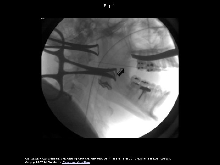 Fig. 1 Oral Surgery, Oral Medicine, Oral Pathology and Oral Radiology 2014 118 e