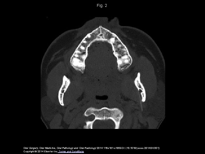 Fig. 2 Oral Surgery, Oral Medicine, Oral Pathology and Oral Radiology 2014 118 e