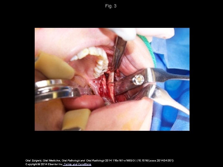 Fig. 3 Oral Surgery, Oral Medicine, Oral Pathology and Oral Radiology 2014 118 e