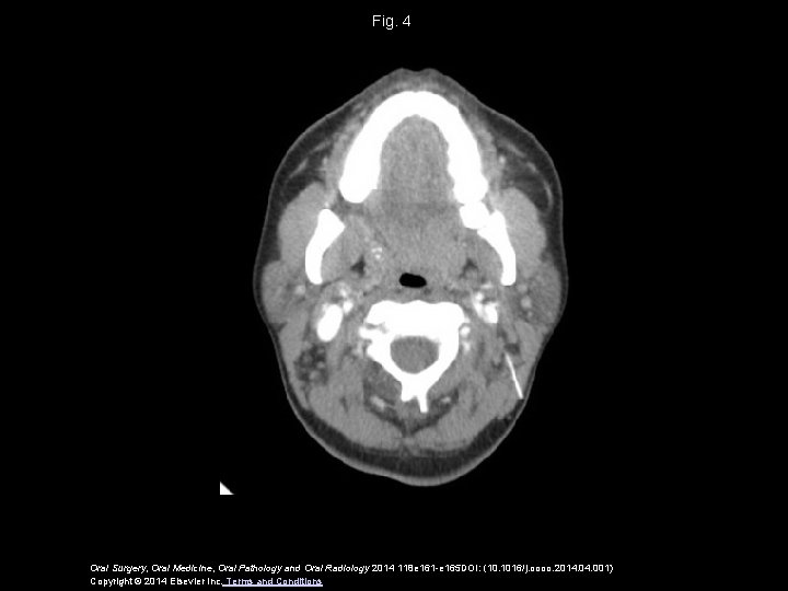 Fig. 4 Oral Surgery, Oral Medicine, Oral Pathology and Oral Radiology 2014 118 e