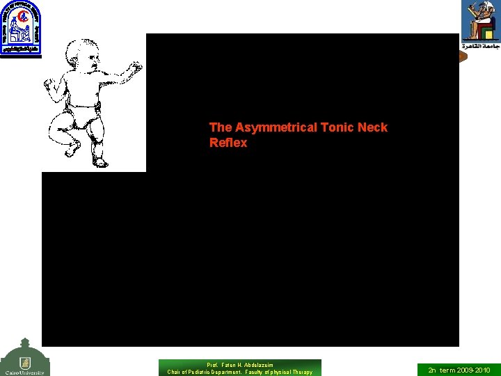 The Asymmetrical Tonic Neck Reflex Prof. Faten H. Abdelazeim Chair of Pediatric Department, Faculty