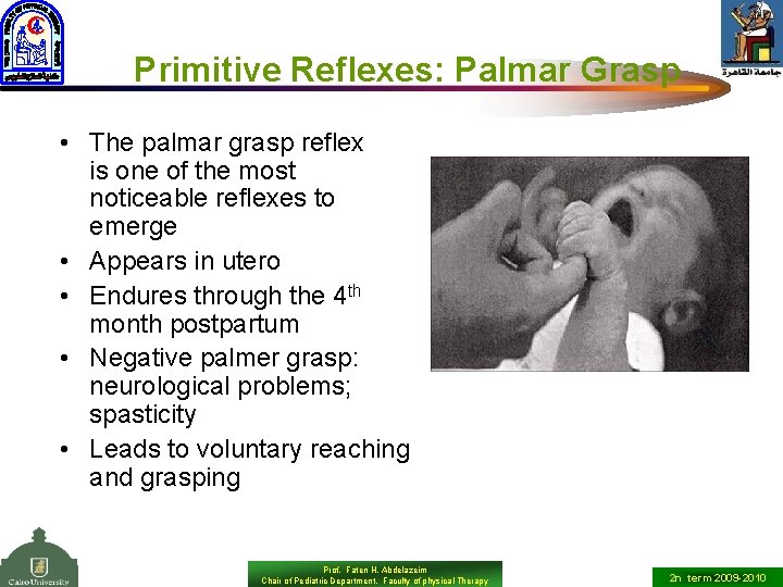 Primitive Reflexes: Palmar Grasp • The palmar grasp reflex is one of the most