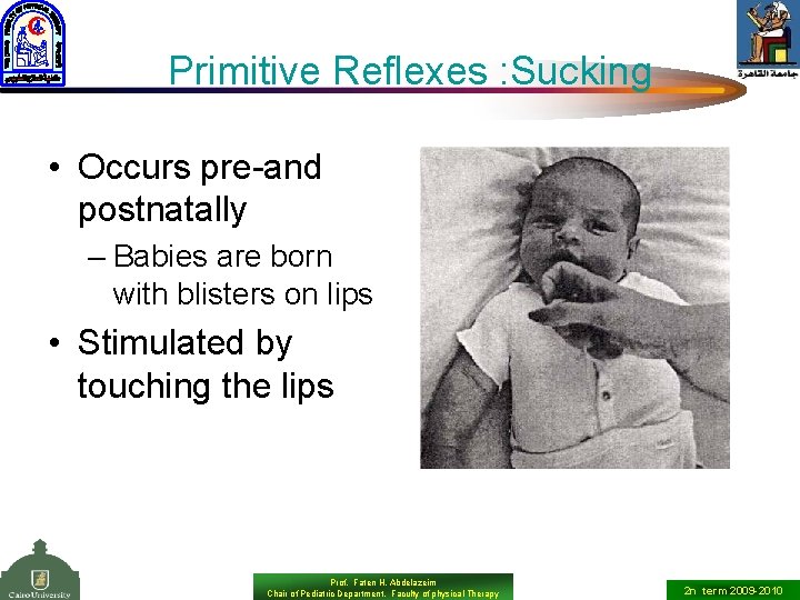 Primitive Reflexes : Sucking • Occurs pre-and postnatally – Babies are born with blisters