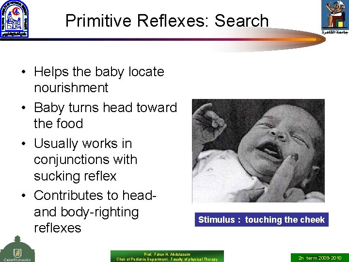 Primitive Reflexes: Search • Helps the baby locate nourishment • Baby turns head toward