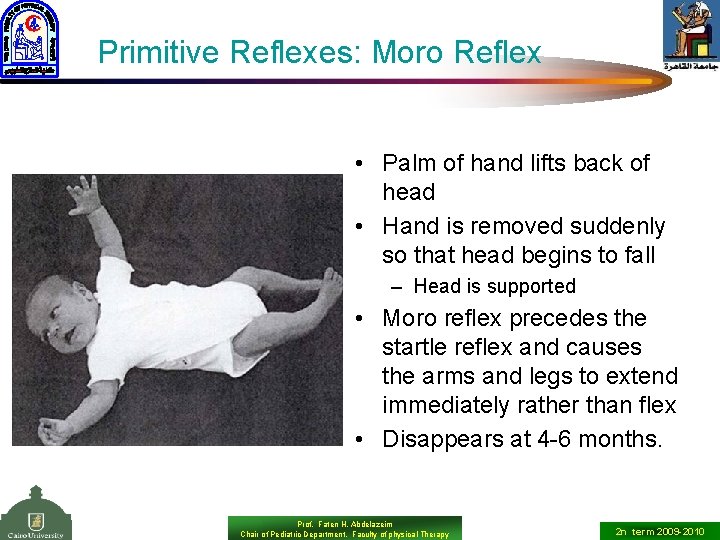Primitive Reflexes: Moro Reflex • Palm of hand lifts back of head • Hand