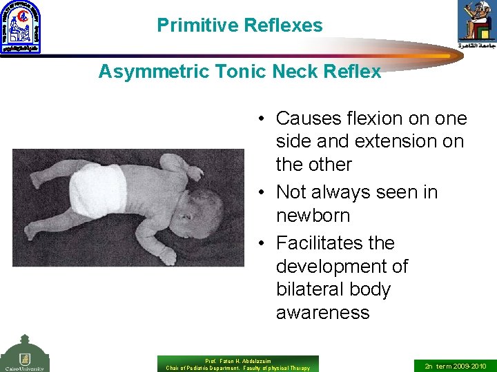 Primitive Reflexes Asymmetric Tonic Neck Reflex • Causes flexion on one side and extension