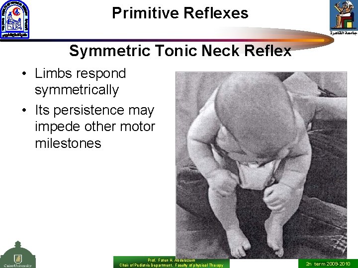 Primitive Reflexes Symmetric Tonic Neck Reflex • Limbs respond symmetrically • Its persistence may