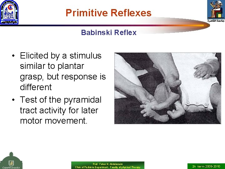 Primitive Reflexes Babinski Reflex • Elicited by a stimulus similar to plantar grasp, but