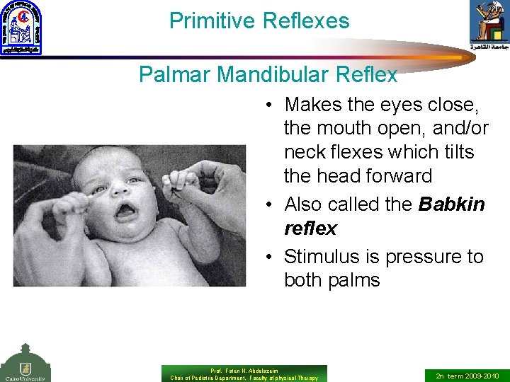 Primitive Reflexes Palmar Mandibular Reflex • Makes the eyes close, the mouth open, and/or