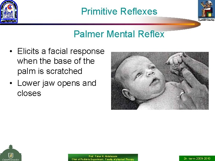 Primitive Reflexes Palmer Mental Reflex • Elicits a facial response when the base of