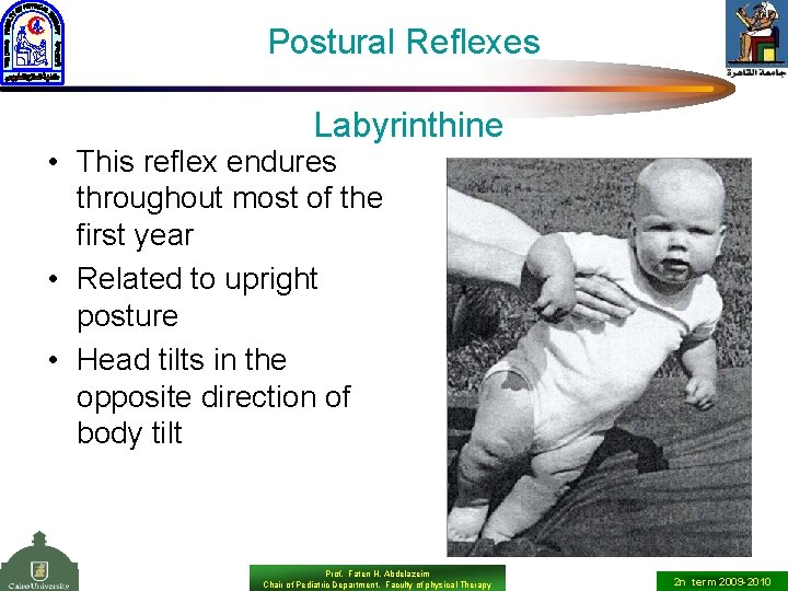 Postural Reflexes Labyrinthine • This reflex endures throughout most of the first year •